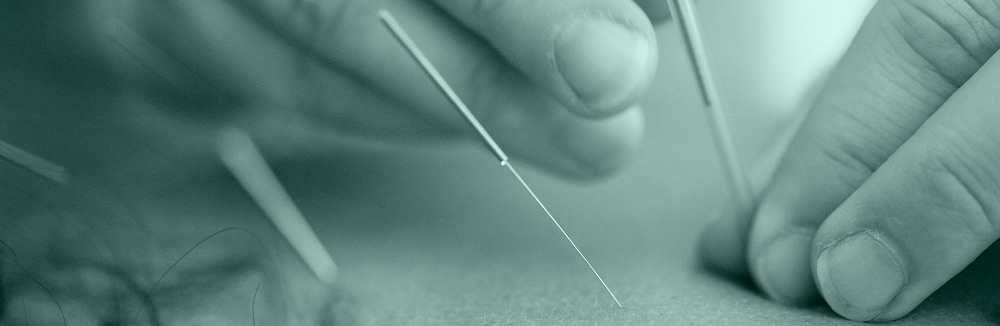acupuncture-stillpoint-in-bath-acupuncture-services